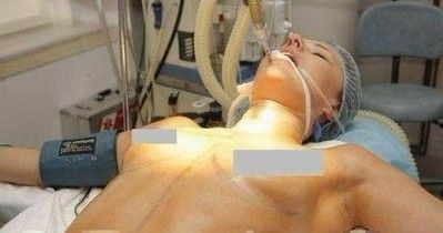 大连女子隆胸早期情况深度解析